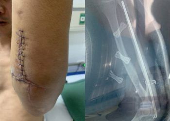 Đi tìm kẻ nhắn tin gạ tình vợ, người đàn ông ở Hải Phòng bị chém trọng thương