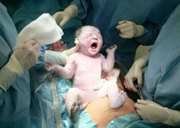 Không cho bác sĩ nam đỡ đẻ, mẹ chồng suýt hại cả con dâu và cháu