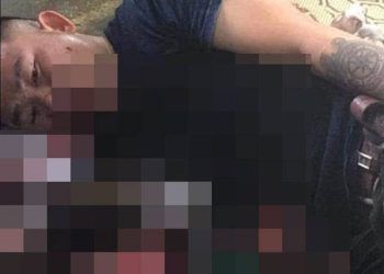 Nổ lớn trong quán cà phê, người đàn ông bị nát bàn tay, thủng bụng