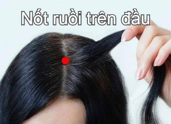 Top 9 nốt ruồi tài lộc quý hơn vàng, ai có 1 thôi là đủ cả đời hưởng phước