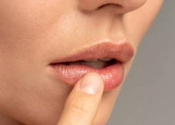 Cách loại bỏ đôi môi nứt nẻ trong mùa đông