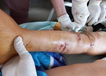 hon mot nghin nguoi bi cho can khi di chuc tet Hơn một nghìn người bị chó cắn khi đi chúc Tết Hơn một nghìn người bị chó cắn khi đi chúc Tết