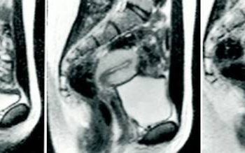 Làm 'chuyện ấy' trong máy chụp cộng hưởng từ và những bức ảnh chấn động