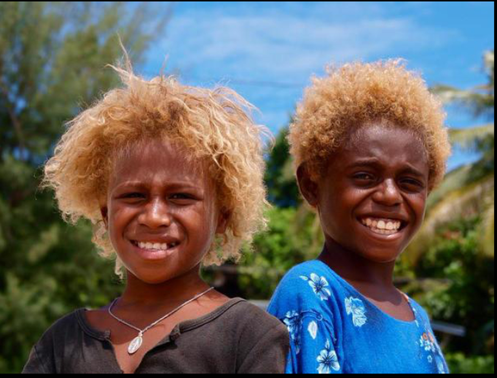 Tại sao lại có những người da đen sở hữu mái tóc vàng tự nhiên?