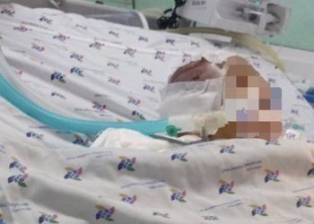 tp hcm be 6 thang tuoi xuat huyet nao nghi bi bao hanh Công an điều tra vụ cháu bé bị dập não khi gửi người khác trông coi ở TP.HCM TP.HCM: Bé 6 tháng tuổi xuất huyết não nghi bị bạo hành