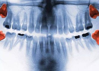 10 bộ phận bị cho là “vô dụng” nhất ở con người