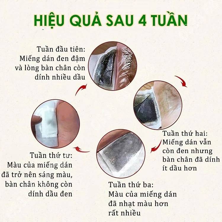 Thực hư công dụng thần kỳ của 'miếng dán thải độc'