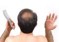 Lợi ích ít biết của đàn ông hói đầu: Vừa tiết kiệm, vừa phòng ngay căn bệnh phổ biến hàng đầu ở nam giới