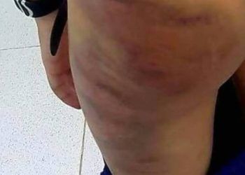 Vụ mẹ kế đánh con chồng Cà Mau: Khởi tố vụ án, điều tra hành vi hành hạ